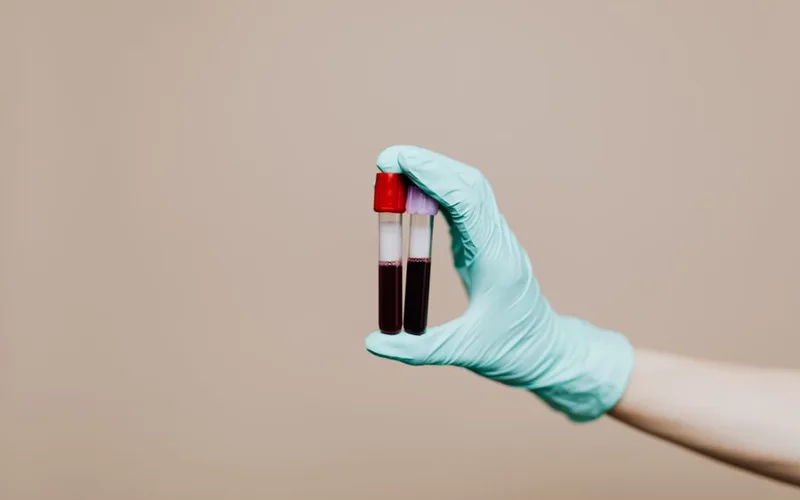 AMH Levels: What They Mean for Fertility