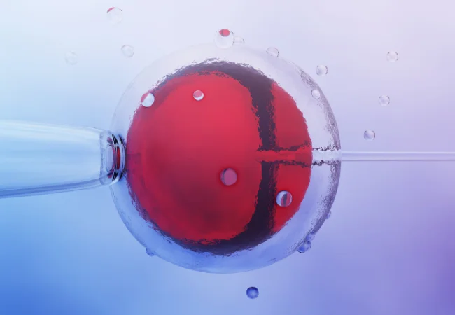 Tüp Bebek (IVF) Tedavisi